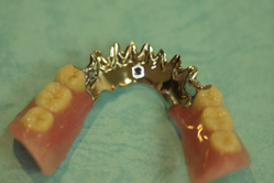 アタッチメント