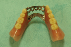 ミリング、インターロック加工