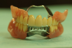 コーヌスクローネ