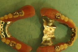 コーヌスクローネ