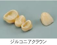 ジルコニアクラウン