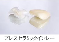 プレスセラミックインレー
