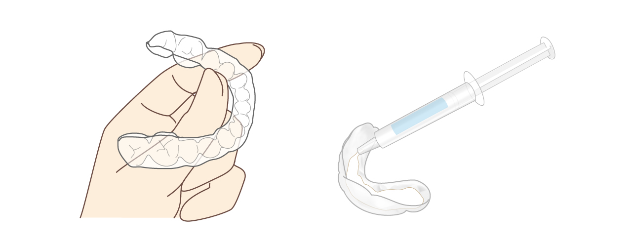 ホワイトニング