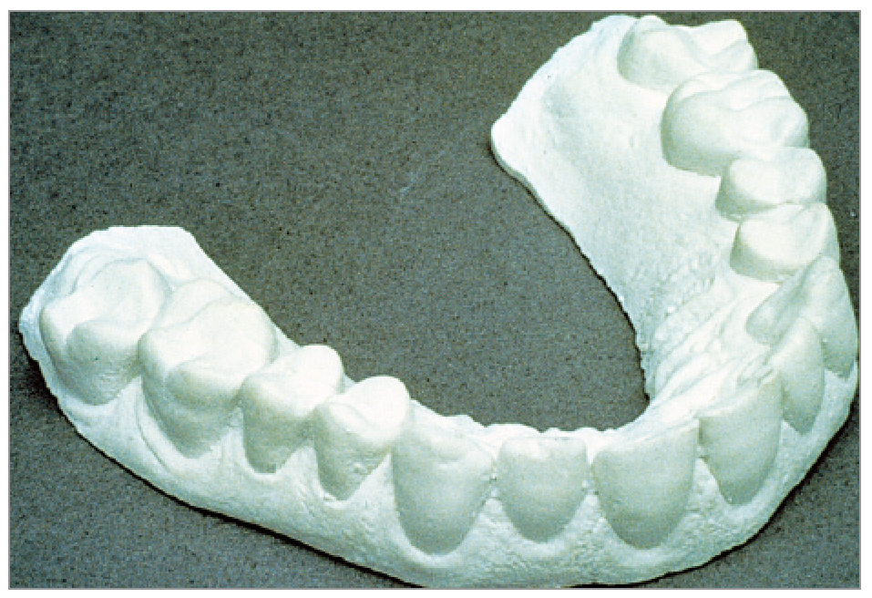 ホワイトニング